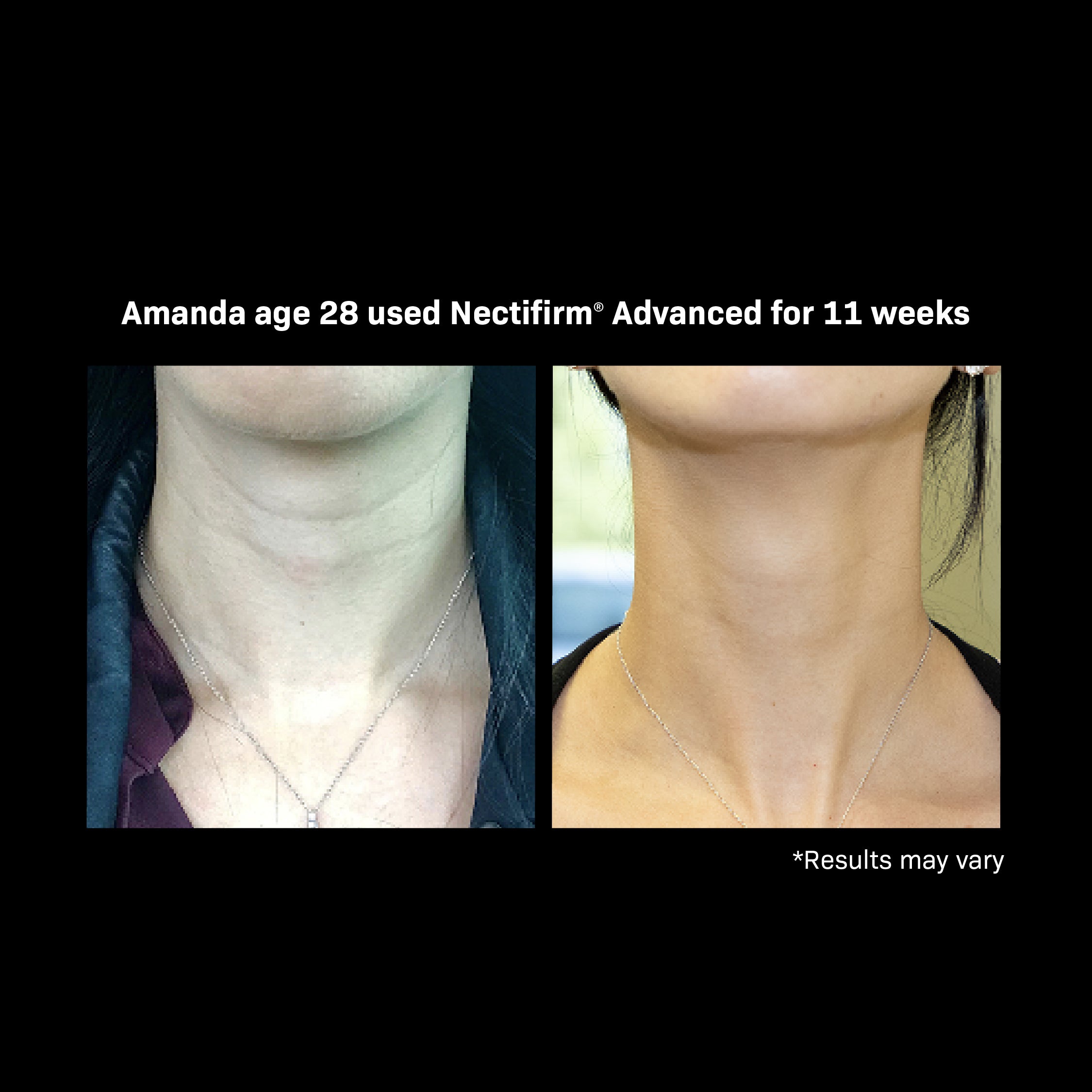 Nectifirm® ADVANCED 0.5 OZ - Imagen 4